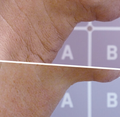 Anti-Aging Face Firming vorher nachher